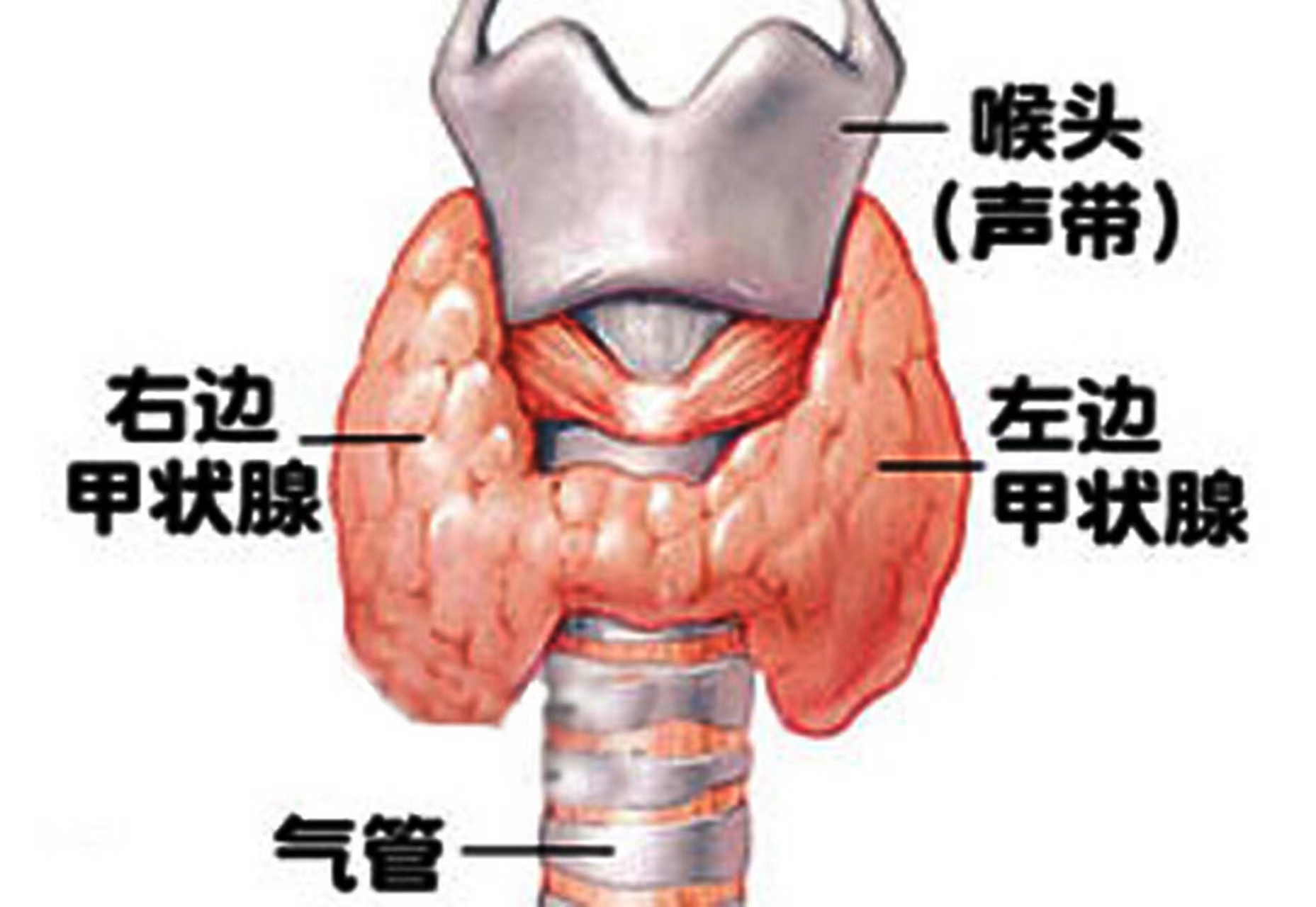 1-230G01Z4515Y.jpg