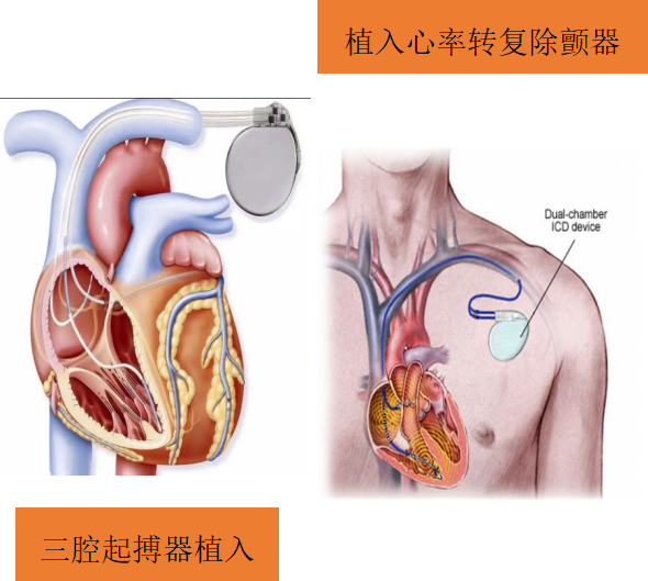 关注心衰，守护心脏(图8)