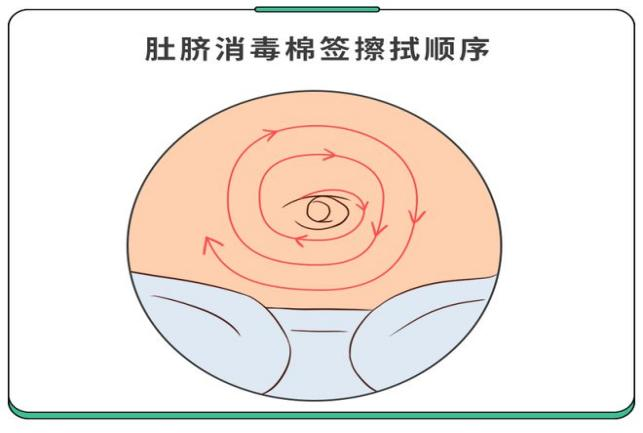 宝宝脐部居家护理(图7)