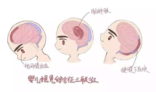 爱的摇篮不摇晃，科学育儿有保障(图4)