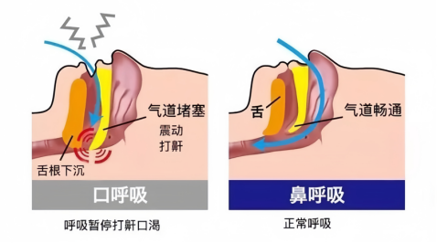 1-25050QQ509494.png