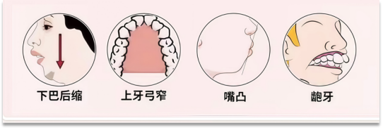 1-25050QQ600332.png