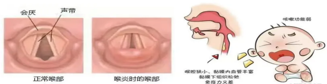 1-250G00PK1548.png