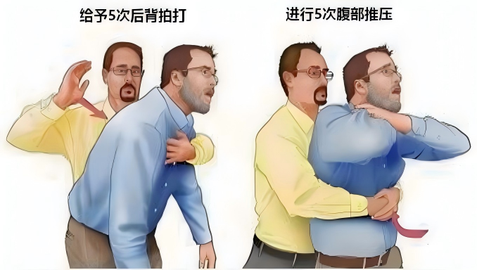 居家急救“小妙招”--关键时刻,别让“好心”办了“坏事”(图2) 1-260923121305624.png